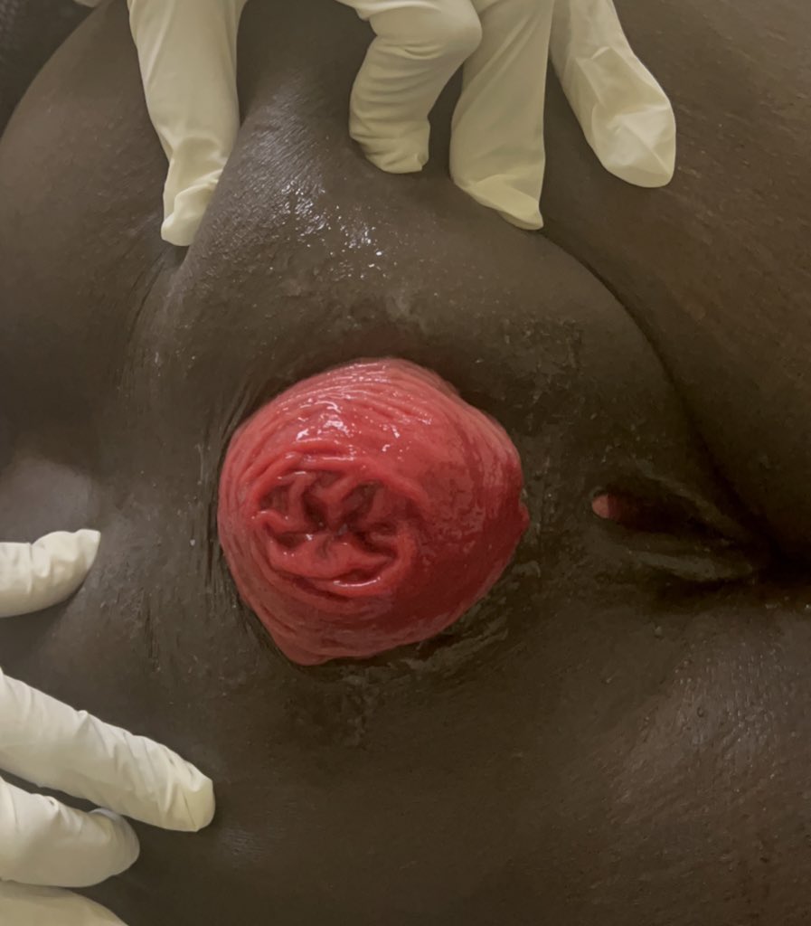 Dr Branice Munyasa advises women not to anal fuck